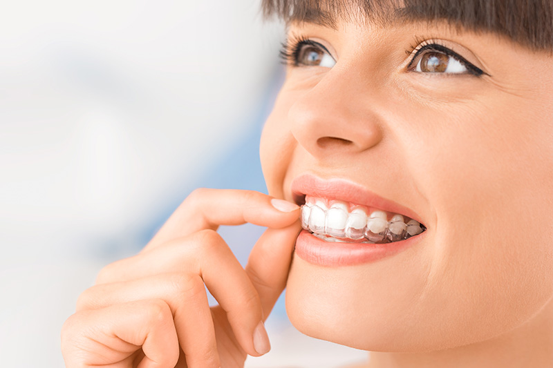 Invisalign Dentist Des Plaines